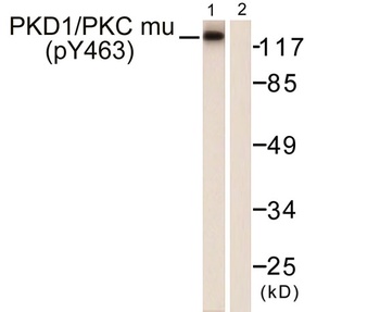 PKD1 (phospho-Tyr463) antibody