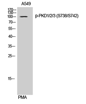 PKD1/2/3 (phospho Ser738/S742) rabbit pAb