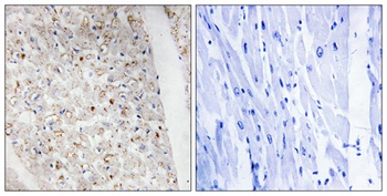 PKD1/2/3 (phospho Ser738/S742) rabbit pAb