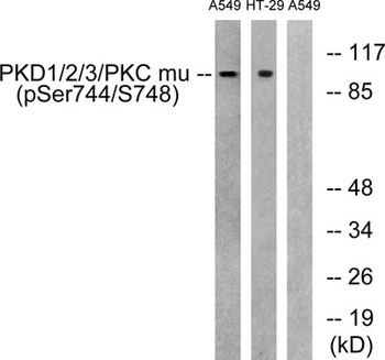 PKD1/2/3 (phospho Ser738/S742) rabbit pAb