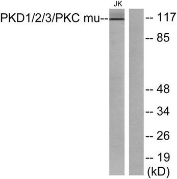 PKD1/2/3 rabbit pAb