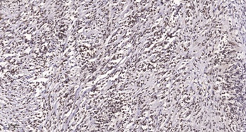 PBK (phospho-Thr9) antibody