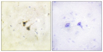 PBK antibody