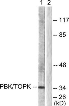 PBK rabbit pAb