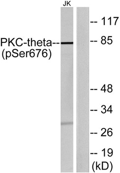 PKC Theta (phospho-Ser676) antibody