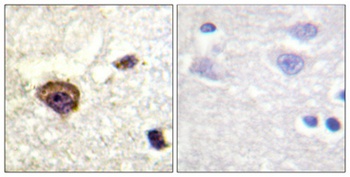 PKC θ (phospho Thr538) rabbit pAb