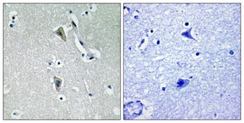 PKC θ (phospho Thr538) rabbit pAb