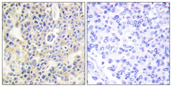 PKC θ (phospho Ser695) rabbit pAb