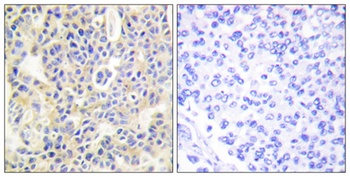 PKC Theta (phospho-Ser695) antibody