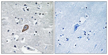 PKC θ rabbit pAb Antibody