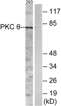 PKC θ rabbit pAb Antibody