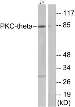 PKC θ rabbit pAb Antibody