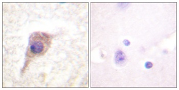 PKC zeta (phospho-Thr560) antibody