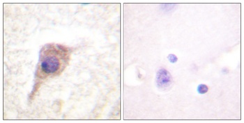 PKC ζ (phospho Thr560) rabbit pAb