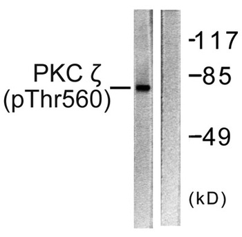 PKC zeta (phospho-Thr560) antibody