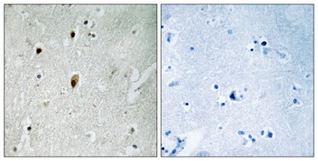 DNA-PKCS (phospho Thr2647) rabbit pAb
