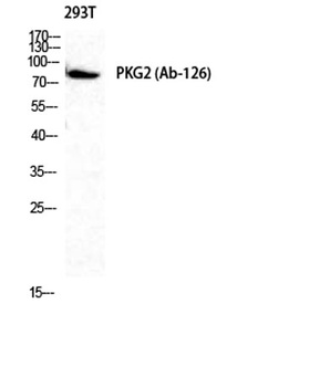 cGKII antibody