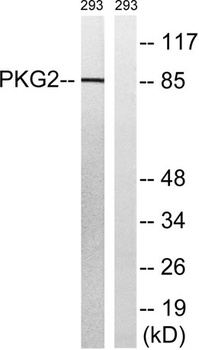 cGKII rabbit pAb