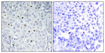 ERK 3 antibody