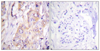 MEK-1 (phospho-Thr286) antibody