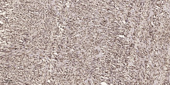 MEK-6 (phospho Ser207) rabbit pAb