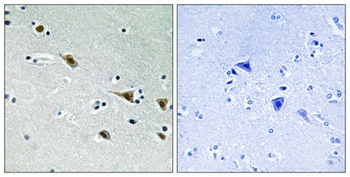 MEK-7 (phospho-Ser271) antibody