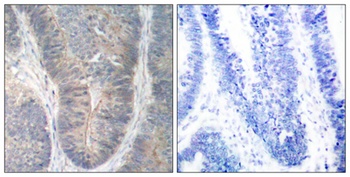 PKR (phospho Thr451) rabbit pAb