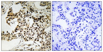 PKR (phospho Thr258) rabbit pAb