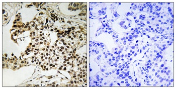 PKR (phospho-Thr258) antibody