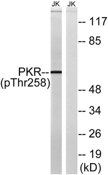 PKR (phospho-Thr258) antibody