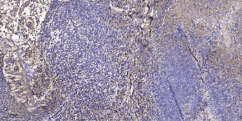 PRKY rabbit pAb Antibody