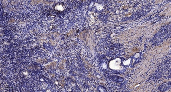 KCNQ5 antibody