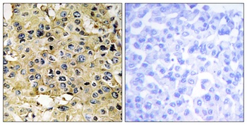 Enterokinase HC rabbit pAb