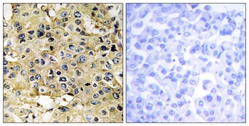 Enterokinase HC antibody