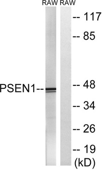 Presenilin 1 rabbit pAb