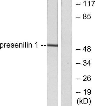 PS-1 antibody