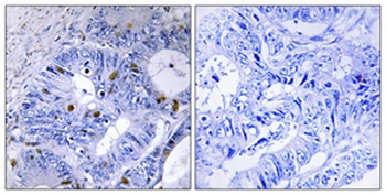 Presenilin 2 (phospho Ser330) rabbit pAb