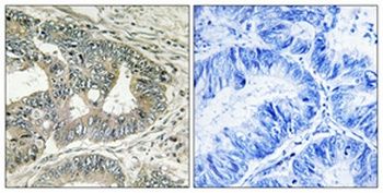 Presenilin 2 (phospho-Ser330) antibody