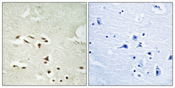 20S Proteasome α3 (phospho Ser250) rabbit pAb