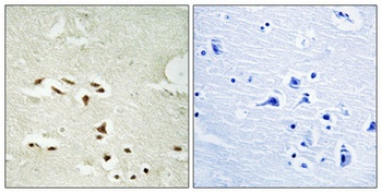 20S Proteasome alpha3 (phospho-Ser250) antibody