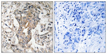 SphK2 antibody