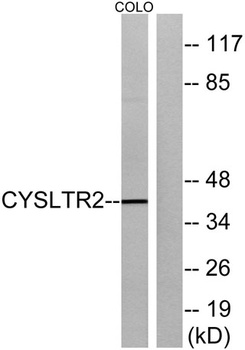 CysLTR2 rabbit pAb