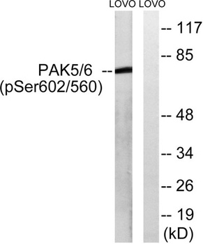 PAK5/6 (phospho Ser602/S560) rabbit pAb