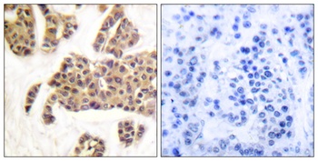 Bad (phospho Ser91) rabbit pAb