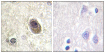 Bad (phospho Ser134) rabbit pAb