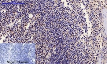 PTEN (phospho-Ser380/T382/T383) antibody
