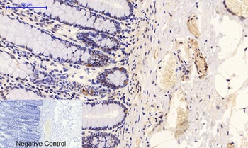 PTEN (phospho-Ser380/T382/T383) antibody