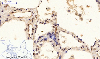 PTEN (phospho-Ser380/T382/T383) antibody