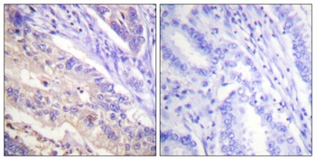 PTEN (phospho Ser385) rabbit pAb