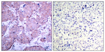 PTEN (phospho Ser380) rabbit pAb